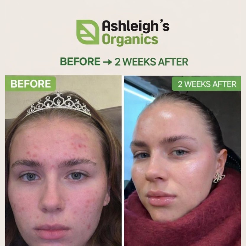 Ashleigh's Organics CBD 🌿Body Butter